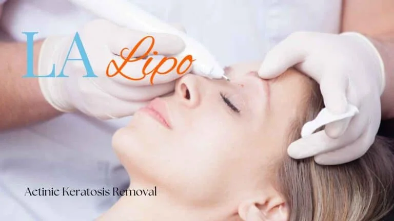 Woman receiving Actinic Keratosis Removal Treatment Windsor
