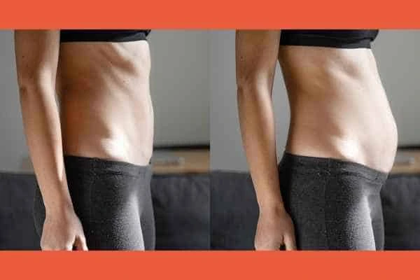 LA-EMS Body Sculpting results Windsor