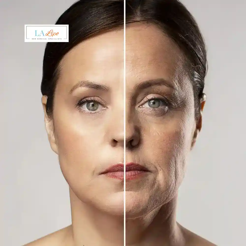 How Can You Tell If Non-Surgical Skin Tightening Is Right for You Windsor?