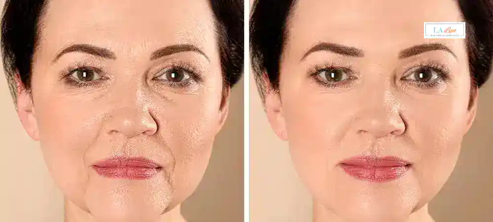 Why Aren’t My Skincare Products Making My Sagging Skin Look Firmer Windsor?