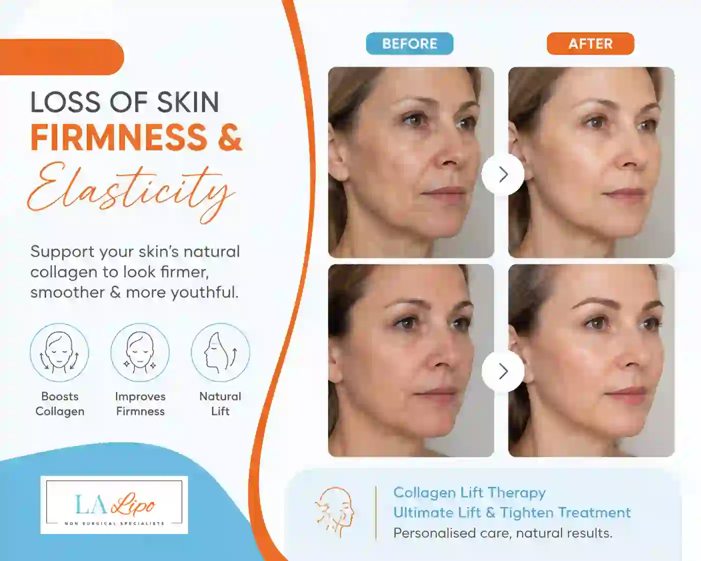 Sign #7: Loss of Skin Firmness and Elasticity Windsor