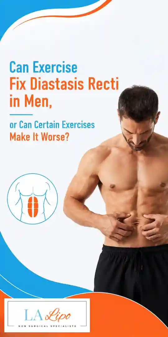 Can Exercise Fix Diastasis Recti in Men, or Can Certain Exercises Make It Worse Windsor?